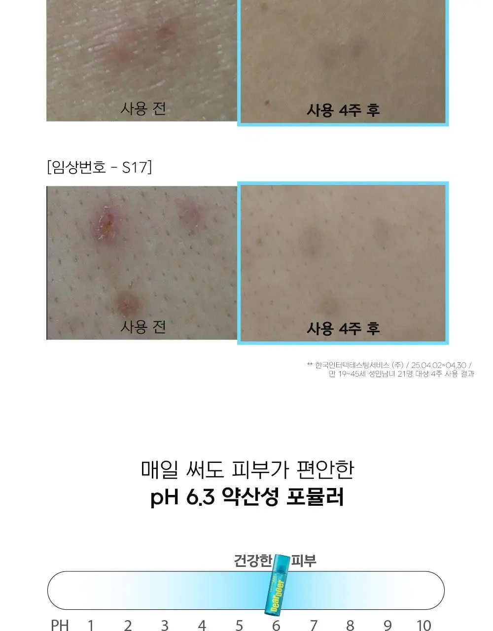 [등드름완화/체취케어] 디어도어 브레이크 PDRN 저자극 바디미스트 200ml 상세페이지 11